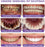 Dental Purple Toothpaste for Teeth Whitening